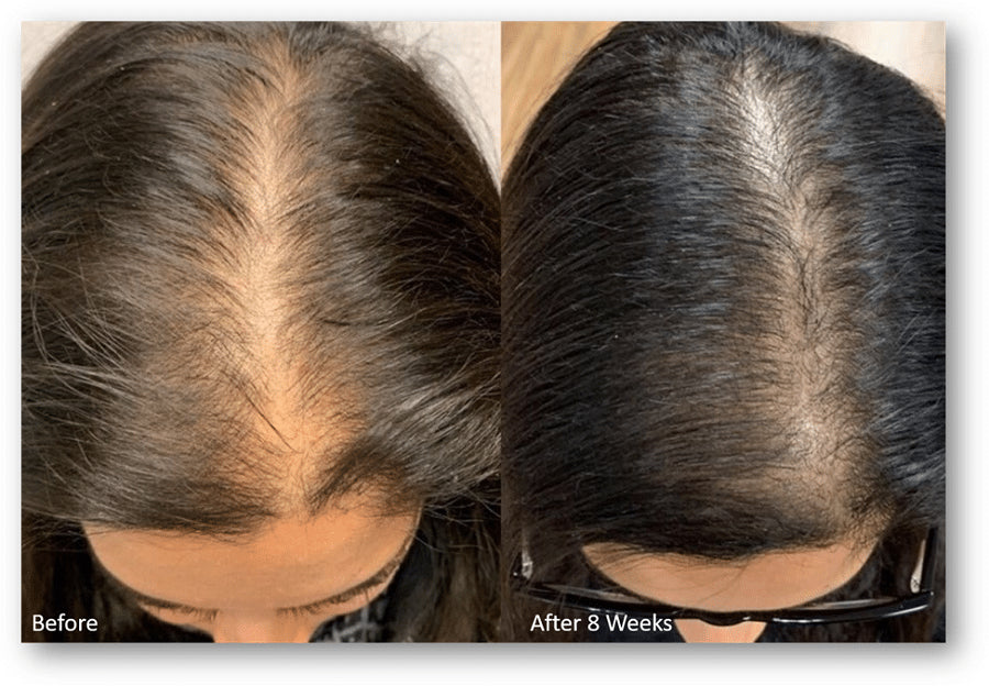 Aurea Hair Treatment